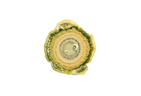 식물 질병 관리